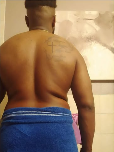 Before Transformation